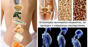 Женский организм скрывает систему защиты от остеопороза