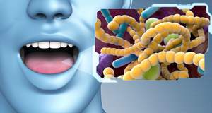 Неприятный запах изо рта и роль бактерий