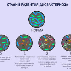 Общие принципы диагностики дисбактериоза кишечника