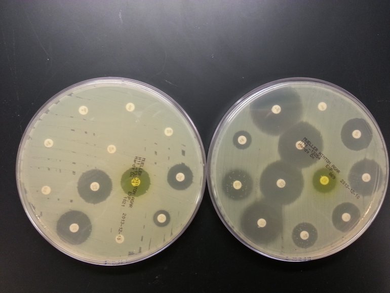 Причина устойчивости грибов к антибиотикам — мутации и специфические ферменты