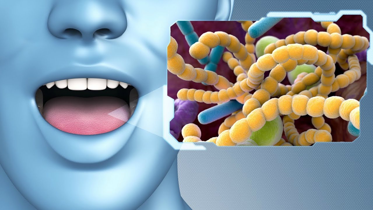 Неприятный запах изо рта и роль бактерий
