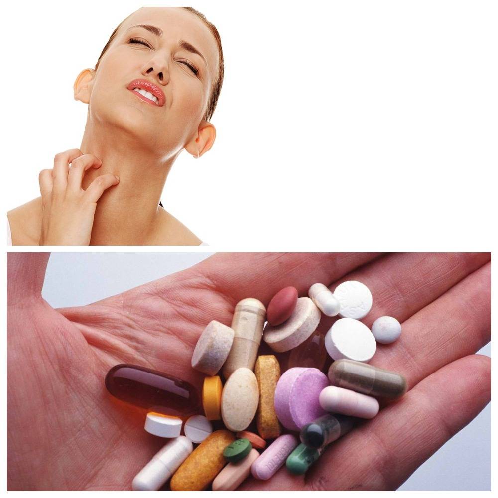 Опасное лекарство. Как узнать о наличии у вас аллергии на препарат?