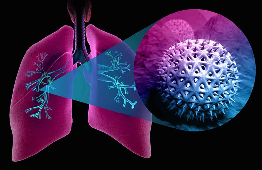 Дисбиоз кишечника у больных бронхиальной астмой и его коррекция